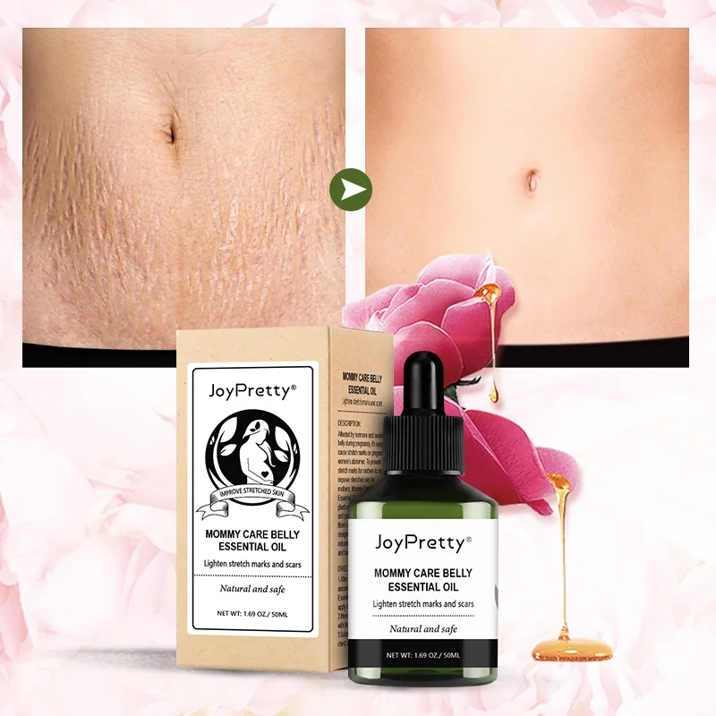 JOYPRETTY To Remove Stretch Marks Essential Oil Pregnant Women Skin Care, Stretching, Pregnant Women, Buttock Body Care
JOYPRETTY To Remove Stretch Marks Essential Oil Pregnant Women Skin Care, Stretching, Pregnant Women, Buttock Body Care