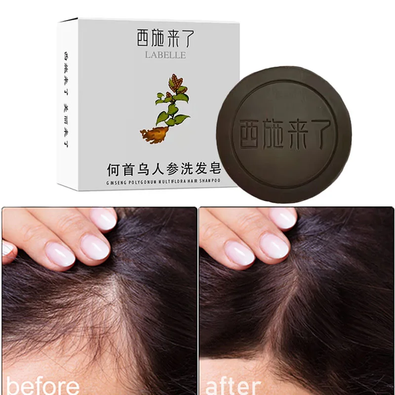 2pcs Soap Hair Darkening Shampoo Bar Solid Shampoo Soap Botanical Formula Shampoo Bar for Hair Regrowth and Hair Loss Treatment
2pcs Soap Hair Darkening Shampoo Bar Solid Shampoo Soap Botanical Formula Shampoo Bar for Hair Regrowth and Hair Loss Treatment