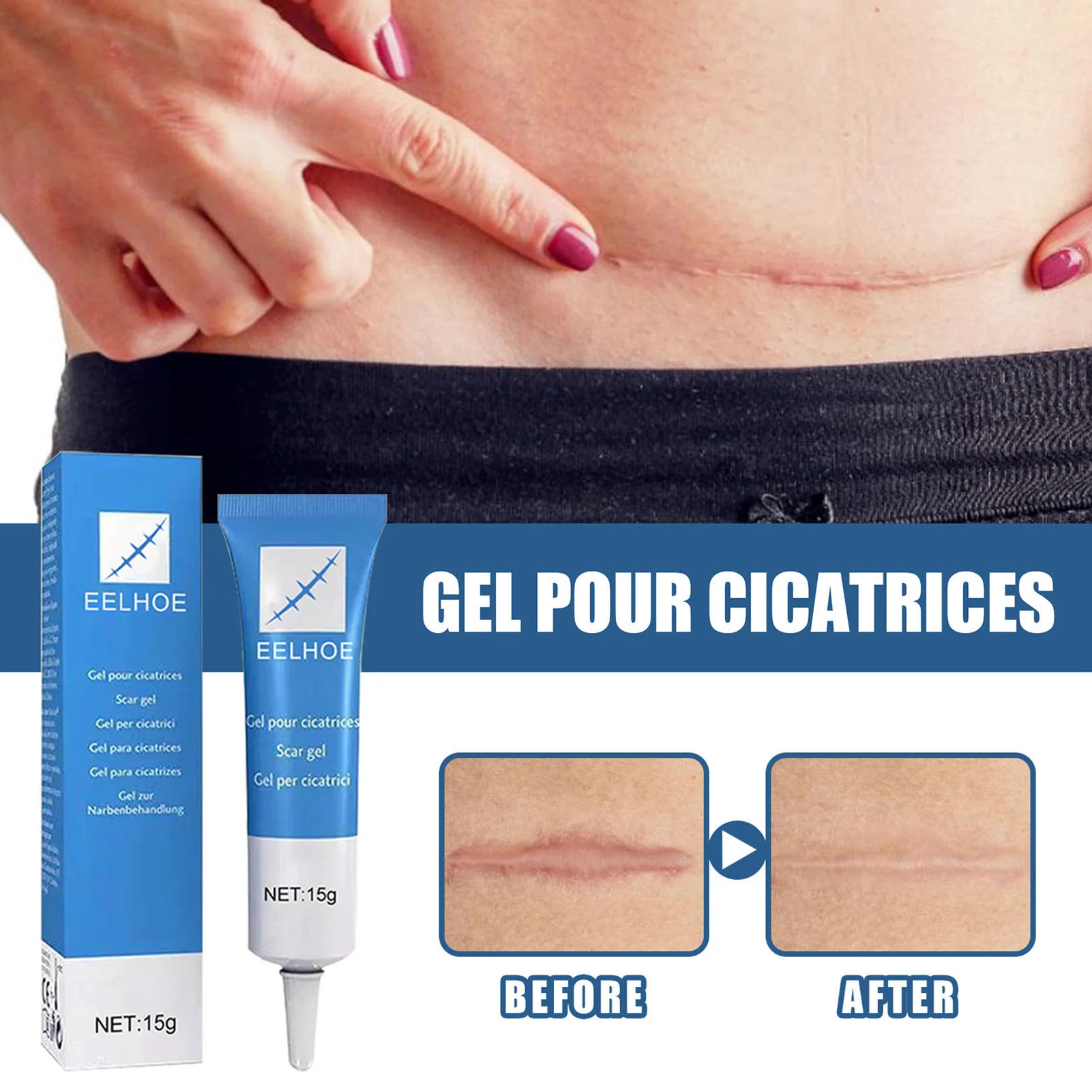 Herbal Scar Removal Cream Gel Stretch Marks Remove Acne Spots Burn Surgical Scars Smooth Whitening Face Body Skin Care
Herbal Scar Removal Cream Gel Stretch Marks Remove Acne Spots Burn Surgical Scars Smooth Whitening Face Body Skin Care