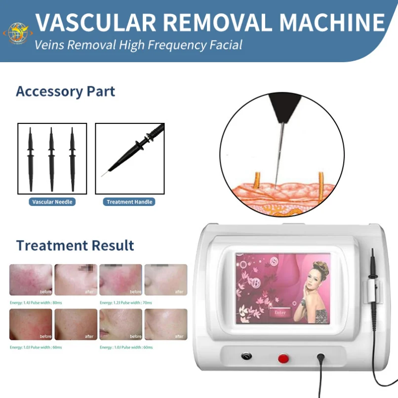 10W Spider Vein Face 980Nm Beauty 980Nm Laser Vascular Brown Spot Removal
10W Spider Vein Face 980Nm Beauty 980Nm Laser Vascular Brown Spot Removal