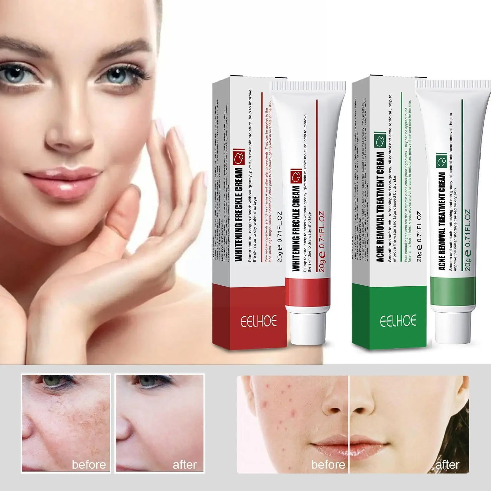 

Acne And Freckle Cream Moisturizing Moisturizing Brightening Moisturizing Cream Cream Blemish Acne Control Skin Oil Whiteni W7B1