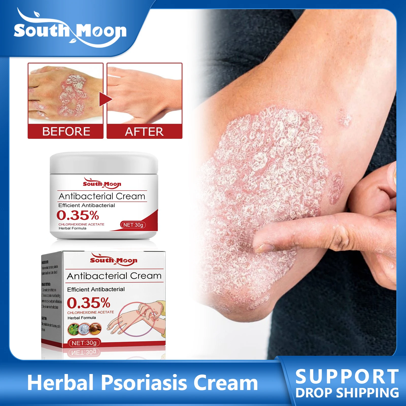 Herbal Psoriasis Cream Treatment Dermatiti Eczema Urticaria Alergy Skin Itching Relief Antibacterial Chinese Medical Ointment
Herbal Psoriasis Cream Treatment Dermatiti Eczema Urticaria Alergy Skin Itching Relief Antibacterial Chinese Medical Ointment