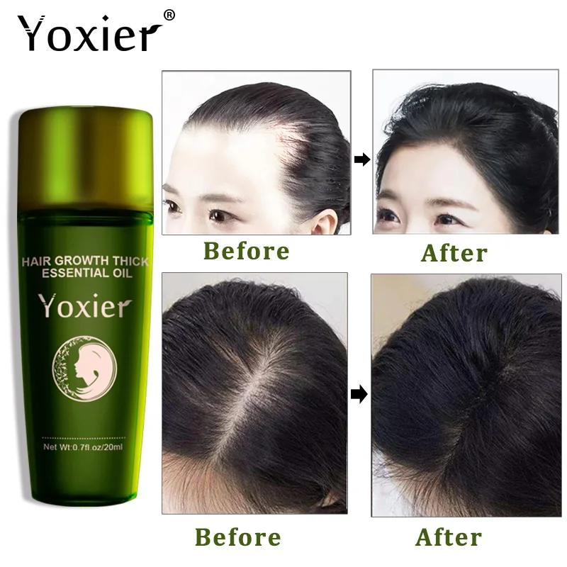 Yoxier Effective Fast Hair Growth Oil Herbal Hair Care Styling Thick Fast Repair Growing Treatment Liquid Anti Hair Loss 20ml
Yoxier Effective Fast Hair Growth Oil Herbal Hair Care Styling Thick Fast Repair Growing Treatment Liquid Anti Hair Loss 20ml