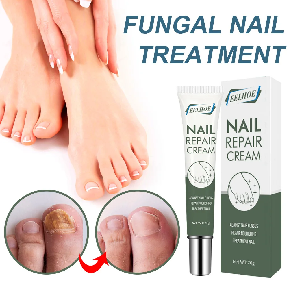 Eelhoe Greyish Nail Repair Cream Fast Greyish Nail Repair Cream Nail Care Ointment Thickening Soft Nail Cream Dropshipping 20g
Eelhoe Greyish Nail Repair Cream Fast Greyish Nail Repair Cream Nail Care Ointment Thickening Soft Nail Cream Dropshipping 20g