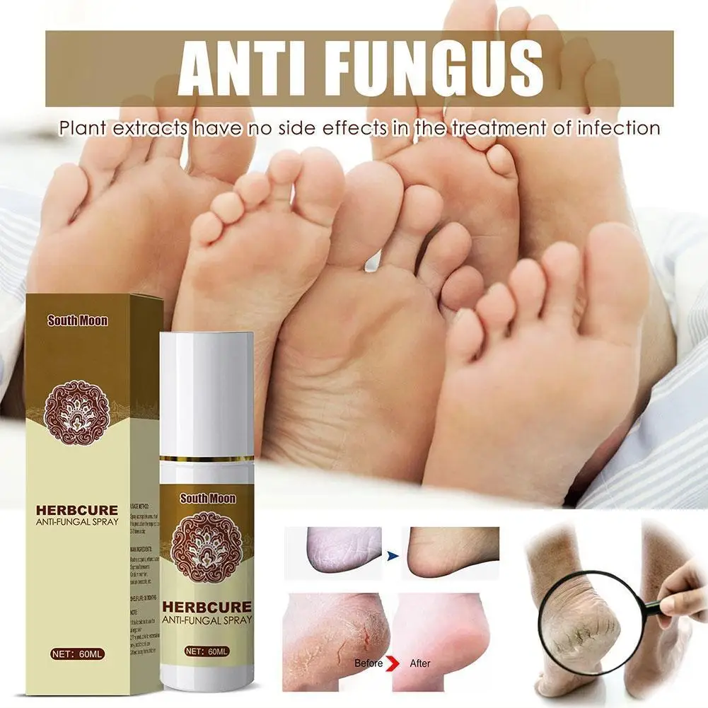60ml Fungal Combat Feet Spray Foot Sterilize Spray Removal Hand Dead Anti-fungal Feet Car Mositurizing Skin Herbal Hands Ca H4S8
60ml Fungal Combat Feet Spray Foot Sterilize Spray Removal Hand Dead Anti-fungal Feet Car Mositurizing Skin Herbal Hands Ca H4S8