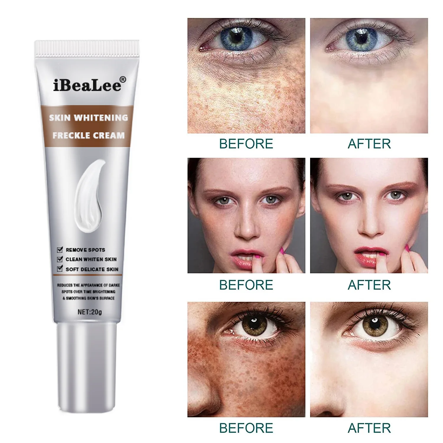 Whitening and Freckle Cream Lighten Spots, Whitening, Moisturizing, Mild and Moisturizing, Improve Dark Yellow Freckle Cream
Whitening and Freckle Cream Lighten Spots, Whitening, Moisturizing, Mild and Moisturizing, Improve Dark Yellow Freckle Cream
