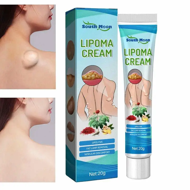 Крем Lipoma эффективный для удаления жира, крем для ухода за кожей с широкими слоями кожи, Растворение, для всего тела
Крем Lipoma эффективный для удаления жира, крем для ухода за кожей с широкими слоями кожи, Растворение, для всего тела