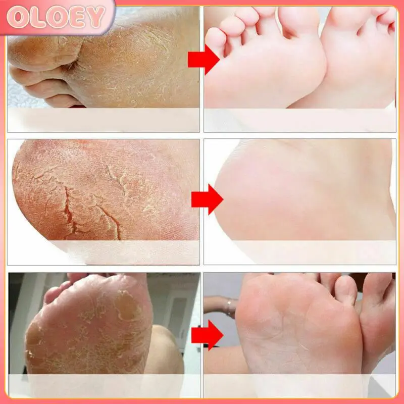 Volcanic Mud Remove Foot Exfoliating Foot Mask Whitening Anti-Aging Moisturizing Peeling Skin Socks Skin Care VIBRANT GLAMOUR
Volcanic Mud Remove Foot Exfoliating Foot Mask Whitening Anti-Aging Moisturizing Peeling Skin Socks Skin Care VIBRANT GLAMOUR