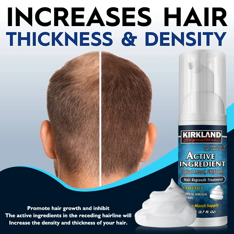 KlRKLAND Hair Growth Mousse,activates Hair Follicles To Hair Loss Prevention,Hair Growth Essence, Reduce Hair Loss
KlRKLAND Hair Growth Mousse,activates Hair Follicles To Hair Loss Prevention,Hair Growth Essence, Reduce Hair Loss