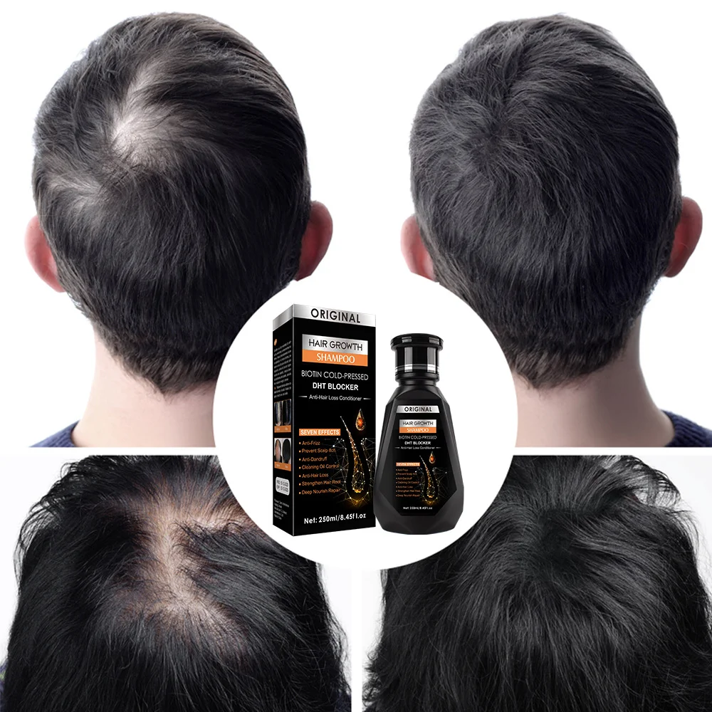 

Disaar Hair Growth Ginger Shampoo Biotin Cold-pressed Anti-hair Loss Conditioner Massage Cream Hair Treatment Skin Care Product