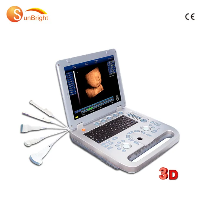 2021 hot sale Portable laptop siemens similar color ultrasound 3d ultrasound echographie portable
2021 hot sale Portable laptop siemens similar color ultrasound 3d ultrasound echographie portable