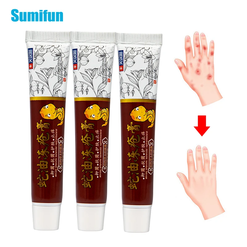 1/2/3Pcs Snake Oil Anti-Cracking Ointment Hand Foot Frozen Frostbite Anti-Chapping Skin Repair Anti Dry Itching Moisturize Cream
1/2/3Pcs Snake Oil Anti-Cracking Ointment Hand Foot Frozen Frostbite Anti-Chapping Skin Repair Anti Dry Itching Moisturize Cream