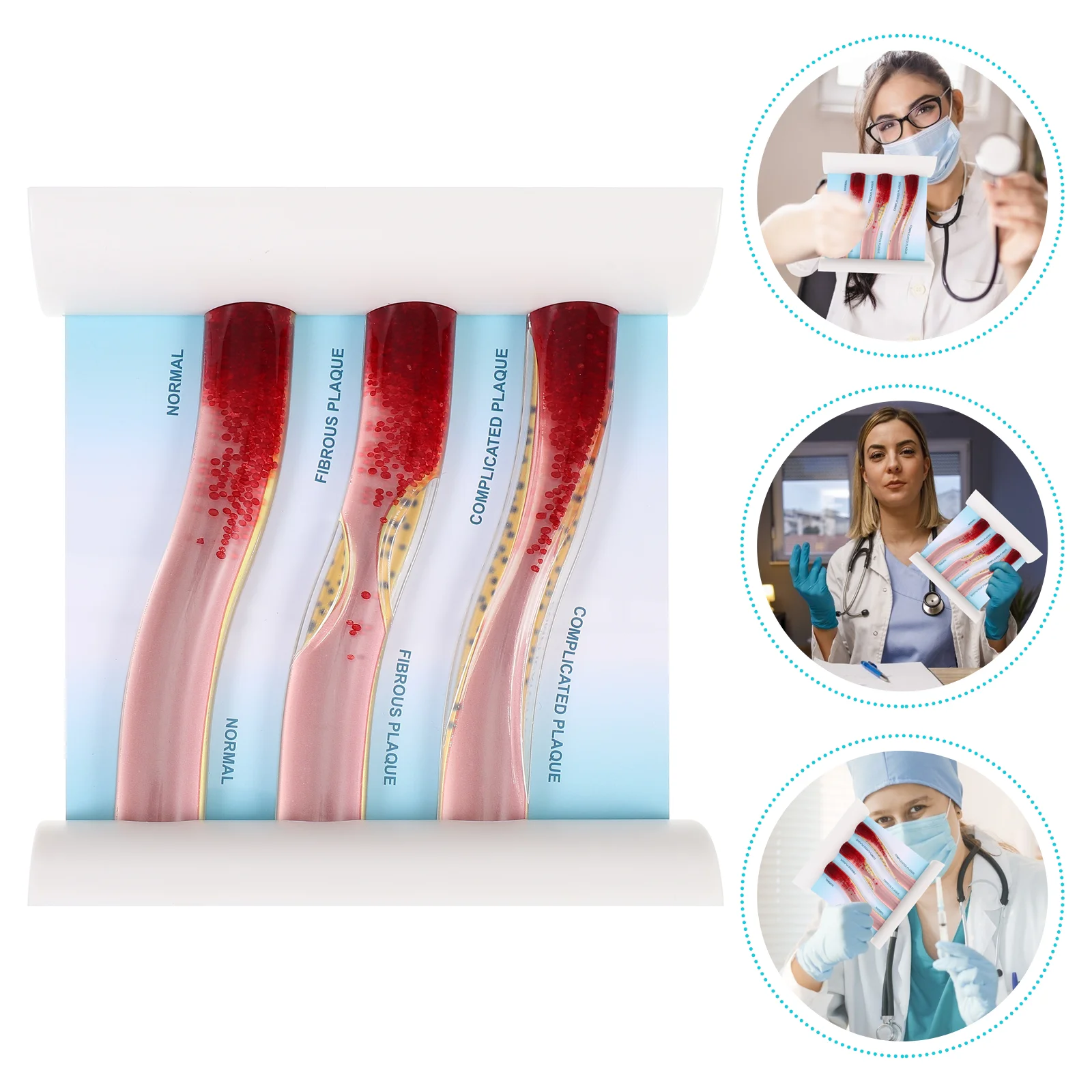 Vascular Model Teaching Blood Vessel LDL Manikin Anatomical Human Body Low Density
Vascular Model Teaching Blood Vessel LDL Manikin Anatomical Human Body Low Density