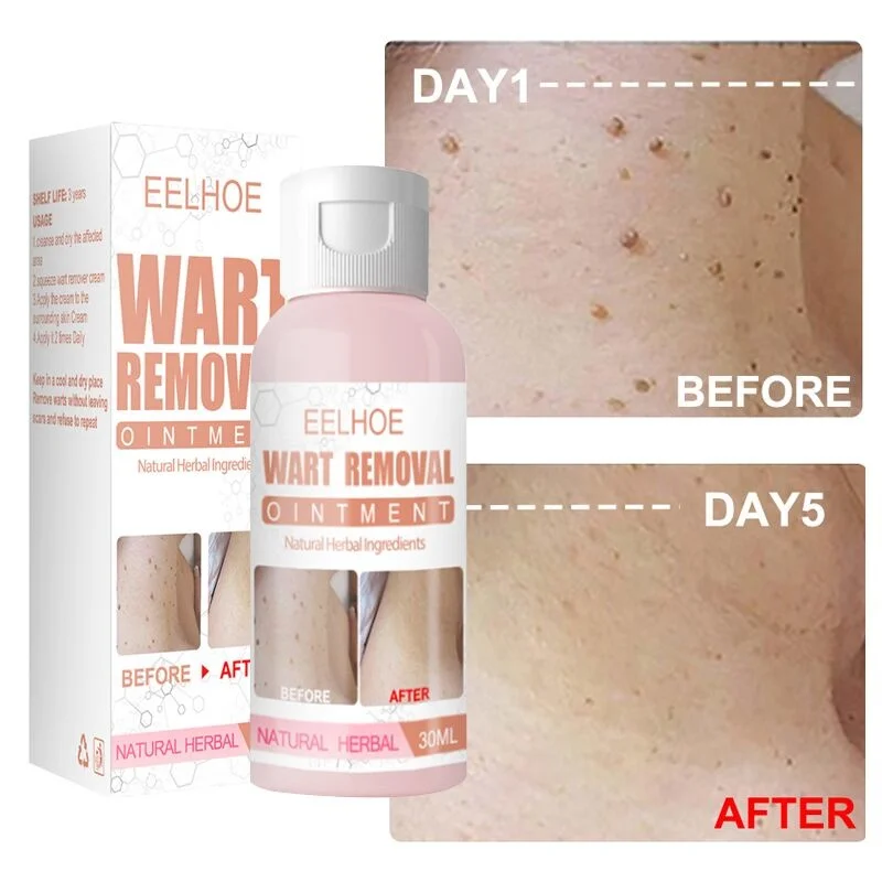 Skin Tag Wart Remover Medical Cream Against Moles Removal Genital Wart Acne Spot Treatment Anti Foot Corn Skin Care Ointment
Skin Tag Wart Remover Medical Cream Against Moles Removal Genital Wart Acne Spot Treatment Anti Foot Corn Skin Care Ointment