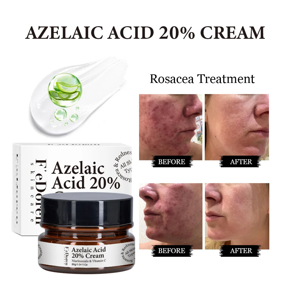 30g Effective Acne Removal Cream Herbal Acne Spots Oil Control Acne Cream Skin Care Whitening Moisturizing Face Gel Skin Care
30g Effective Acne Removal Cream Herbal Acne Spots Oil Control Acne Cream Skin Care Whitening Moisturizing Face Gel Skin Care