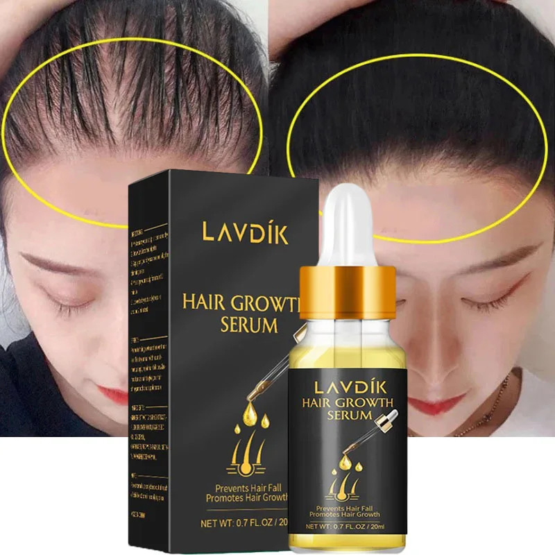 

7 Days Hair Growth Essential Oil Products Anti Hair Loss Essence Fast Growing Nourish Soften Scalp Repair Damaged Hair Care 20ml