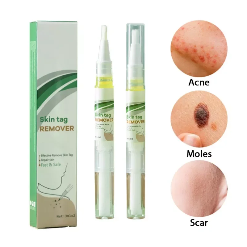 Skin Tag Remover Genital Wart Treatment Instant Removal Mole&Papillomas Foot Corn Repair Tool Natural Bacteriostatic Liquid
Skin Tag Remover Genital Wart Treatment Instant Removal Mole&Papillomas Foot Corn Repair Tool Natural Bacteriostatic Liquid