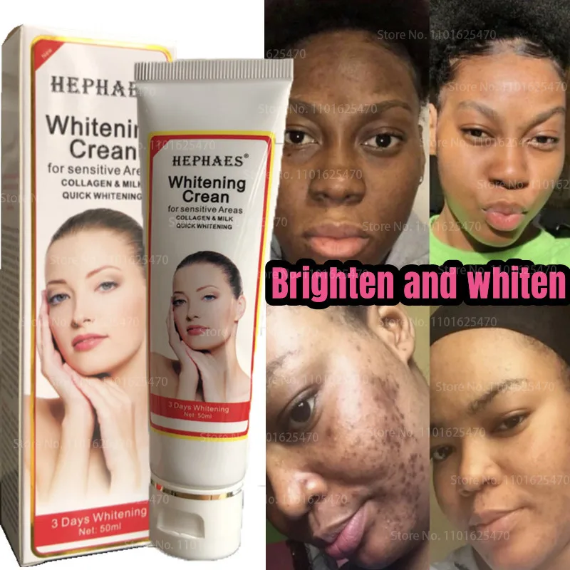 Powerful Effective Skin Lightening Cream for Brightening Complexion for Dark Skin The Private Parts of Elbows Knees Whitening
Powerful Effective Skin Lightening Cream for Brightening Complexion for Dark Skin The Private Parts of Elbows Knees Whitening