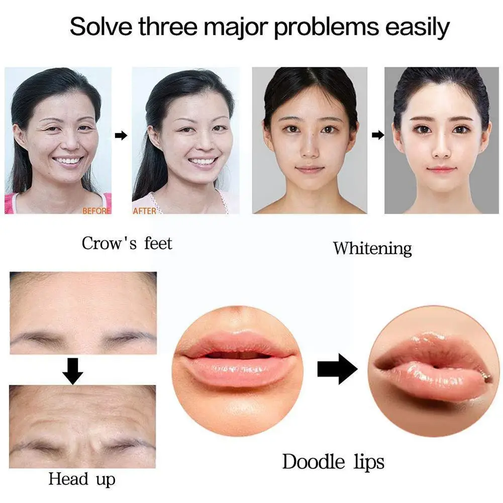 2ml Small Molecule Hyaluronic Acid Filler Lip/nose/cheek Hyaluronic Acid Crosslinked Ha Lips Enhancement Use For Hyaluron P N7z0
2ml Small Molecule Hyaluronic Acid Filler Lip/nose/cheek Hyaluronic Acid Crosslinked Ha Lips Enhancement Use For Hyaluron P N7z0