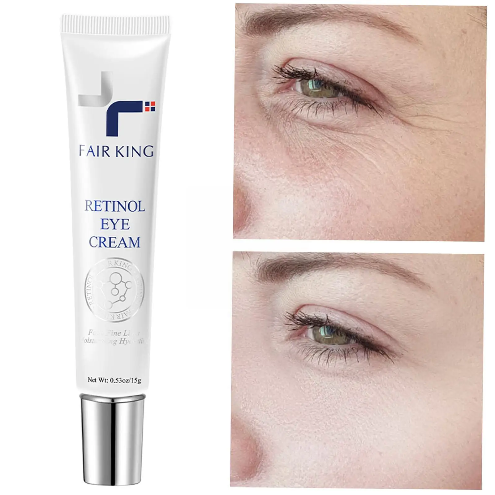 Retinol Eye Cream Anti-aging Removal Eye Bags Fade Moisturizing A Vitamin Metabolism Accelerate Cream Skin Eye Care Wrinkle P6M7
Retinol Eye Cream Anti-aging Removal Eye Bags Fade Moisturizing A Vitamin Metabolism Accelerate Cream Skin Eye Care Wrinkle P6M7