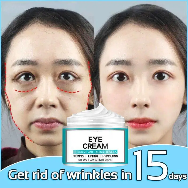 Advanced retinol eye cream lightens dark circles and fine lines, removes eye bags, anti wrinkle, anti-aging
Advanced retinol eye cream lightens dark circles and fine lines, removes eye bags, anti wrinkle, anti-aging