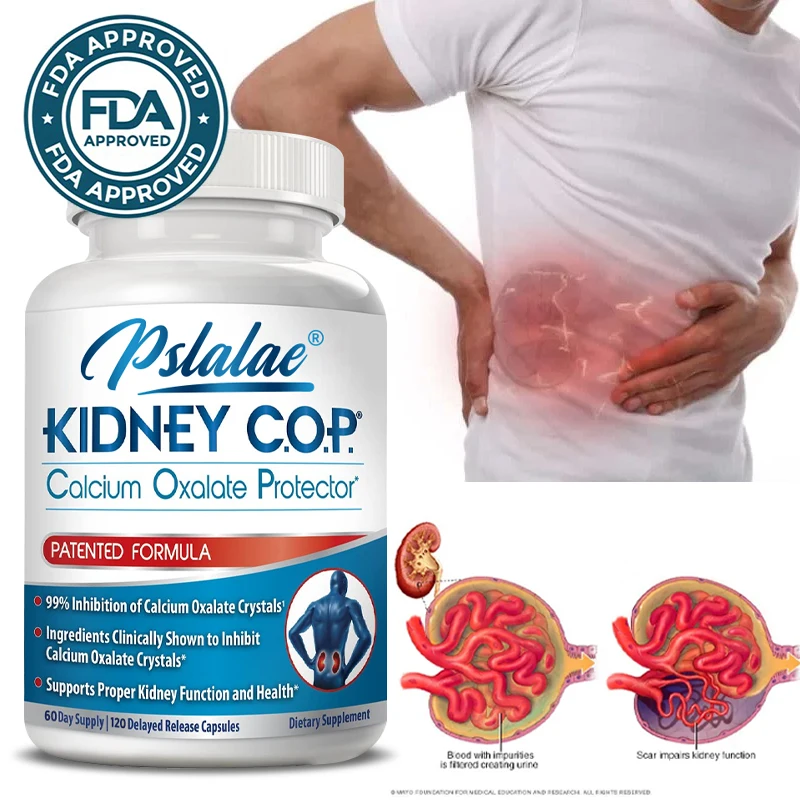 

Kidney COP Calcium Oxalate Protector 120 Capsules Patented Calcium Oxalate Crystals Kidney Support To Help Stop Stone Recurrence