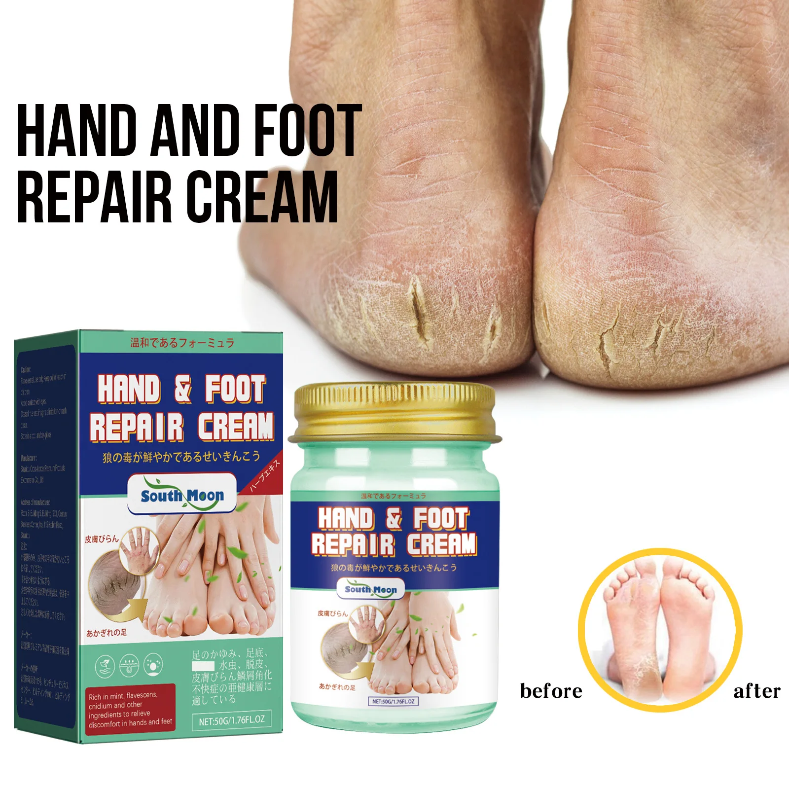 Hand Foot Repair Cream Herbal Antibacterial Relieve Moss Itching Anti Freeze Repair Dry Crack Peeling Rough Moisturizing Skin
Hand Foot Repair Cream Herbal Antibacterial Relieve Moss Itching Anti Freeze Repair Dry Crack Peeling Rough Moisturizing Skin