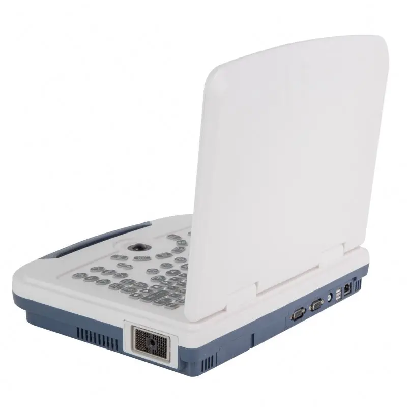 Portable usg laptop ultrasound cheap human ultrasonic scanner prices of ultrasound machine
Portable usg laptop ultrasound cheap human ultrasonic scanner prices of ultrasound machine