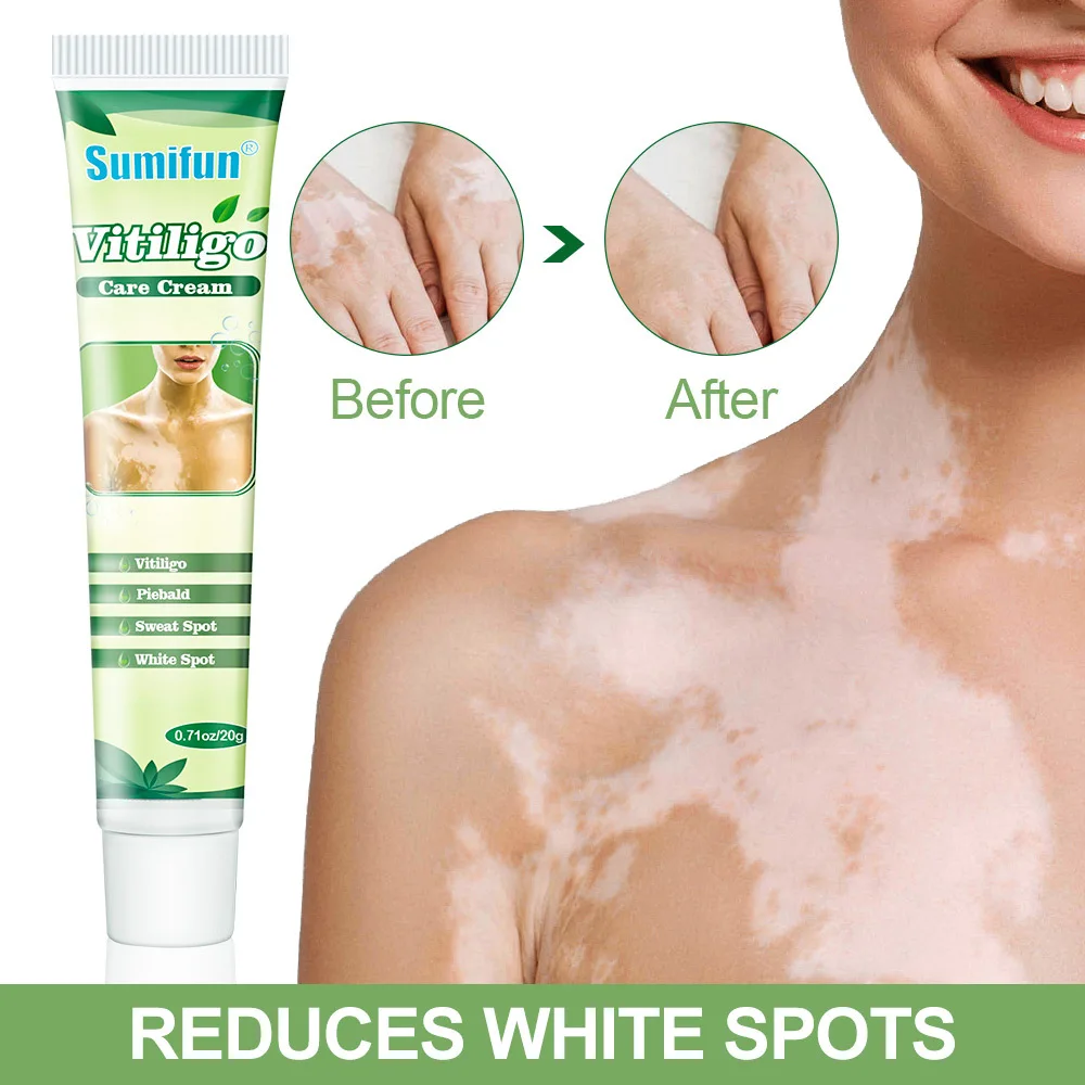 White Sweat Spot VitiligoTreament Cream Antibacterial Cream Psoriasis Localized Vitiligo Ointment Mycosis Leukoplakia Treatment
White Sweat Spot VitiligoTreament Cream Antibacterial Cream Psoriasis Localized Vitiligo Ointment Mycosis Leukoplakia Treatment