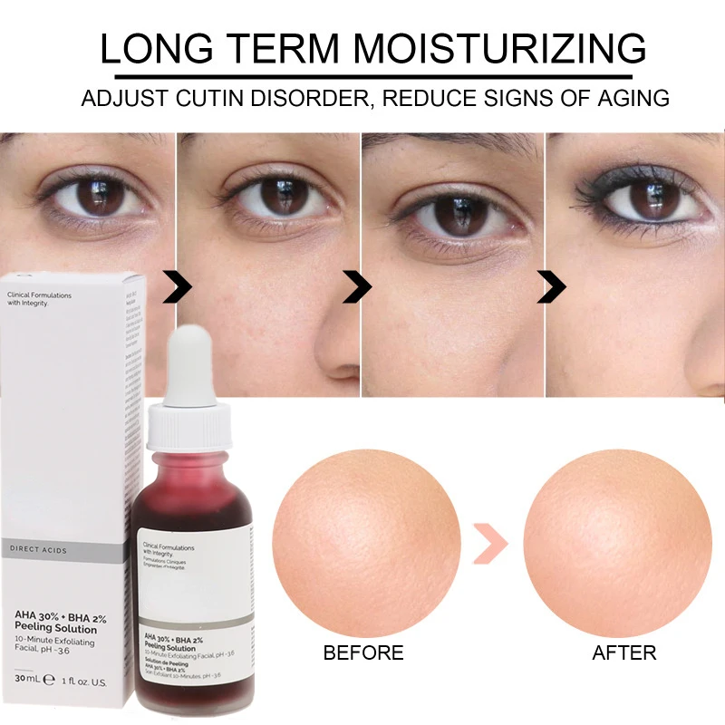 Face Solution AHA 30% + BHA 2% Makeup Peeling Acne Removing Serum Repair Hyaluronic Moisturizer Acid Face Skin Care
Face Solution AHA 30% + BHA 2% Makeup Peeling Acne Removing Serum Repair Hyaluronic Moisturizer Acid Face Skin Care