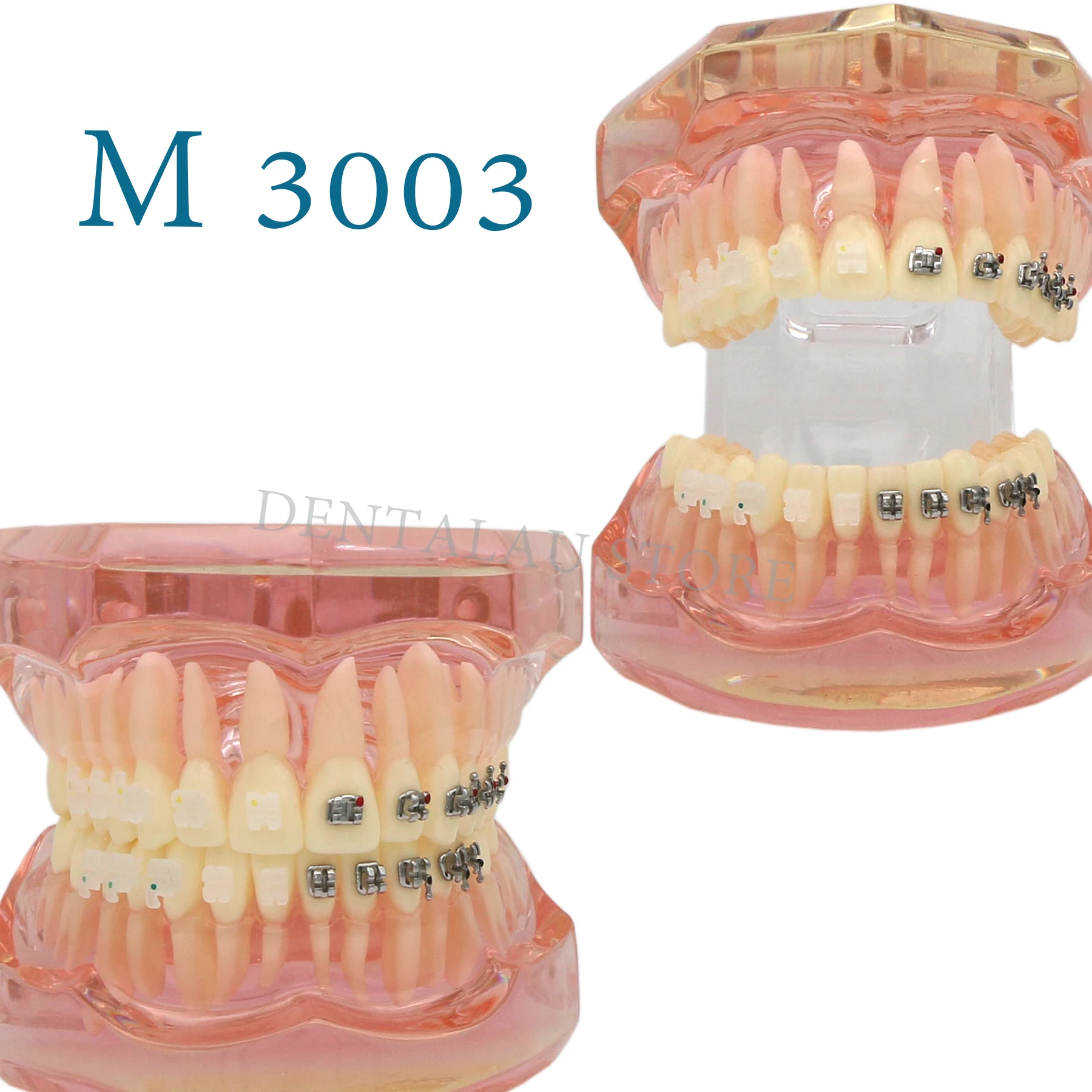 Dental M3003 PINK material Ceramic Bracket Braces Orthodontic Teeth Study Model with ceramic brackets Dental teaching model
Dental M3003 PINK material Ceramic Bracket Braces Orthodontic Teeth Study Model with ceramic brackets Dental teaching model