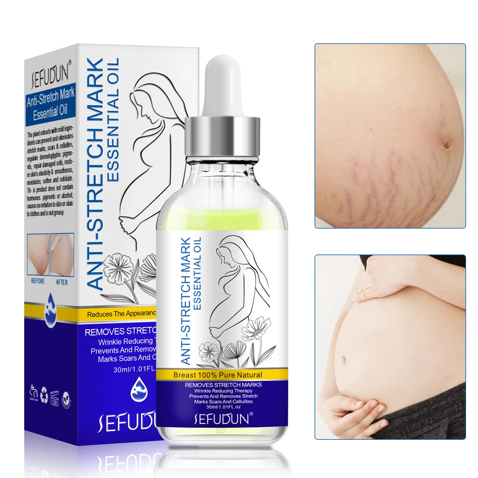 SEFUDUN Postpartum Repair Cream To Dilute Stretch Marks Pregnant Women's Fat Lines Repair Stretch Marks Smooth Pregnant Belly
SEFUDUN Postpartum Repair Cream To Dilute Stretch Marks Pregnant Women's Fat Lines Repair Stretch Marks Smooth Pregnant Belly