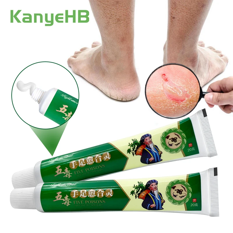 2pcs Foot Repair Ointment Anti Crack Foot Care Cream Heel Chapped Foot Peeling Removal Calluses Dead Skin Hand Feet Care A1604
2pcs Foot Repair Ointment Anti Crack Foot Care Cream Heel Chapped Foot Peeling Removal Calluses Dead Skin Hand Feet Care A1604