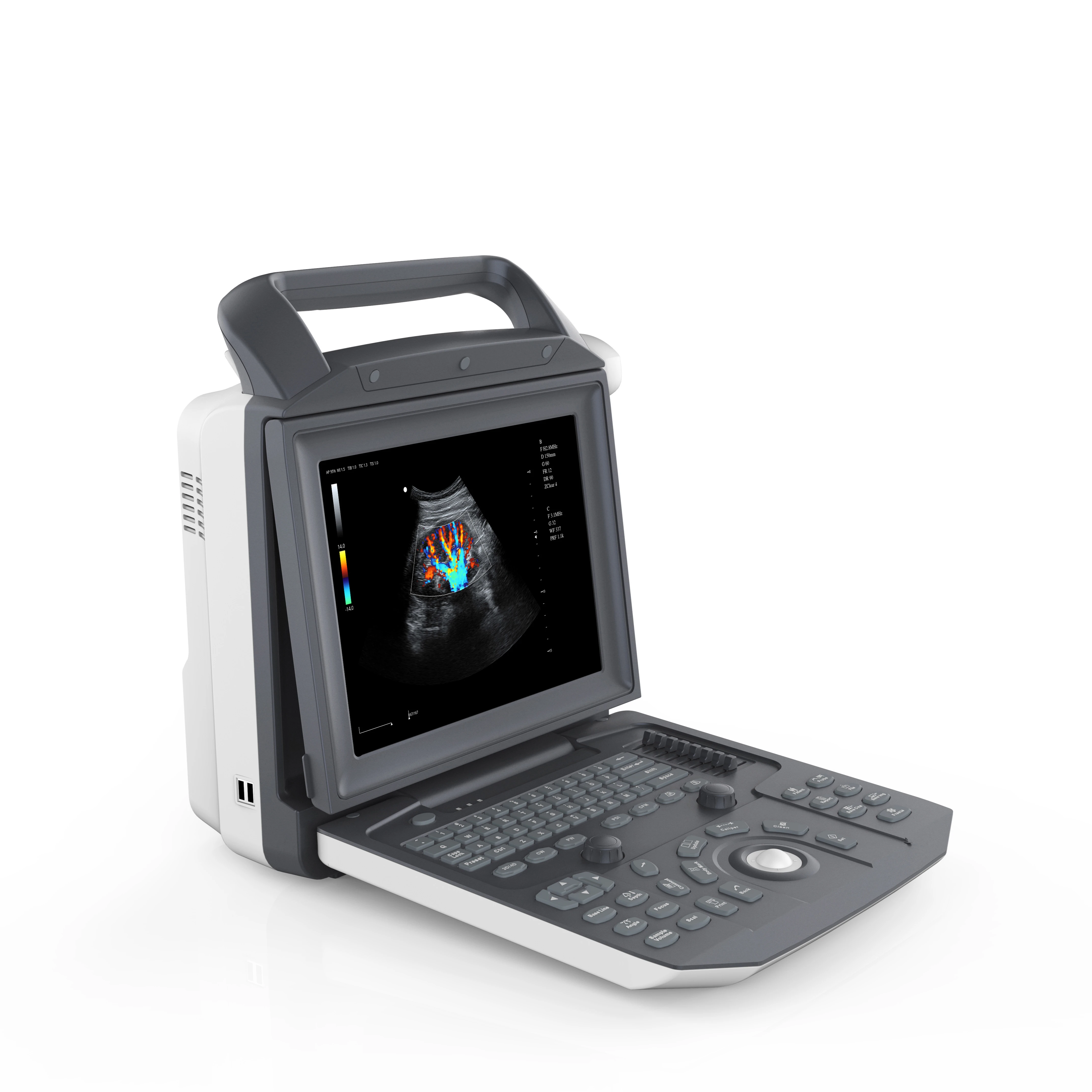 Color doppler PIHI Obstetrics, Cardiac, Urology ultrasound machine portable
Color doppler PIHI Obstetrics, Cardiac, Urology ultrasound machine portable