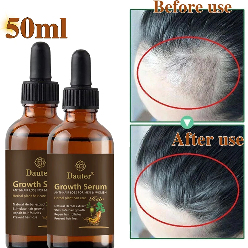 Hair regeneration essence prevents hair lossnourishes and softens the scalprepairs damaged hair and healthy hair growth
Hair regeneration essence prevents hair lossnourishes and softens the scalprepairs damaged hair and healthy hair growth