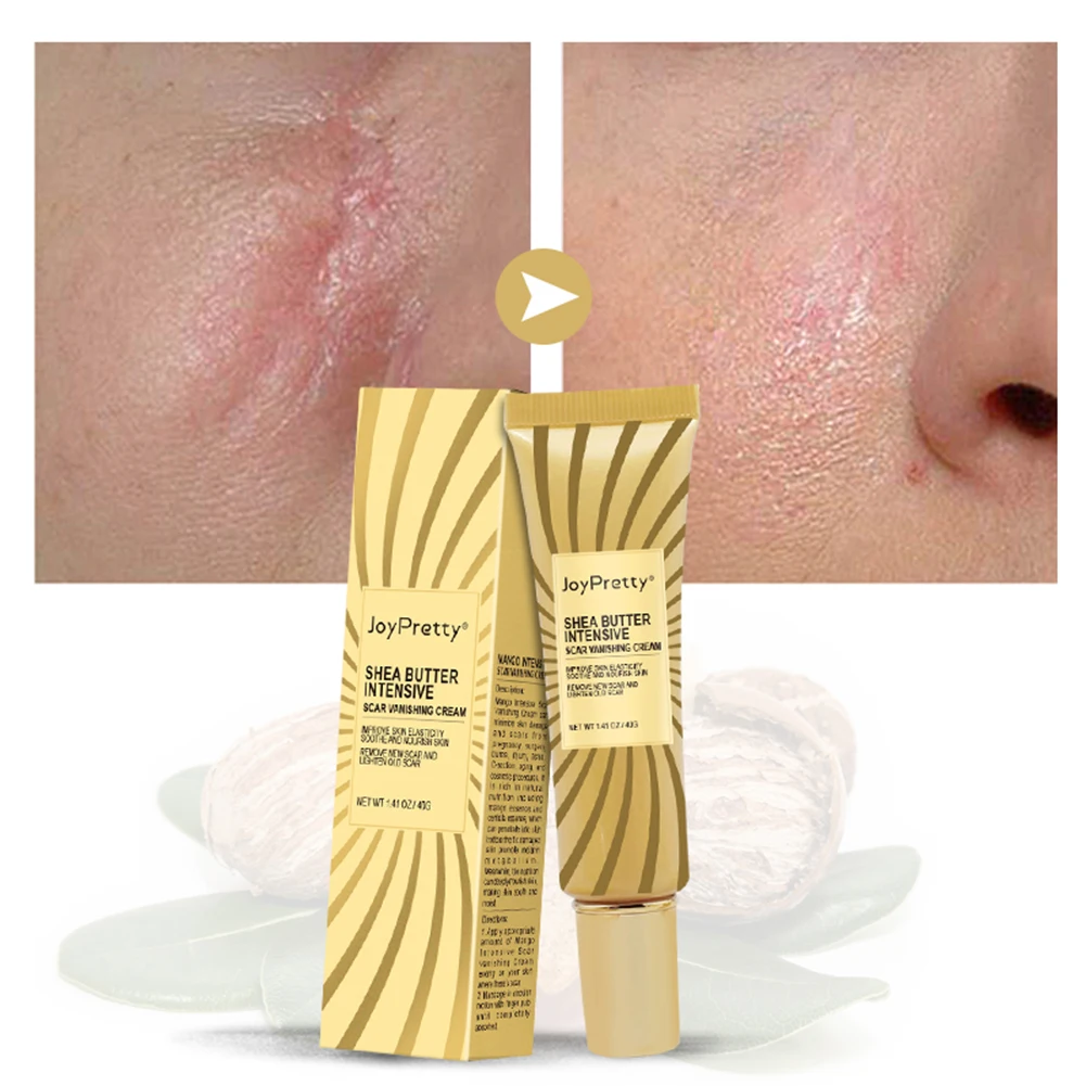 Acne Scar Removal Cream Remove Acne Scars Stretch Marks Burns Gel Smoothing Repairing Moisturizing Body Skin Care
Acne Scar Removal Cream Remove Acne Scars Stretch Marks Burns Gel Smoothing Repairing Moisturizing Body Skin Care