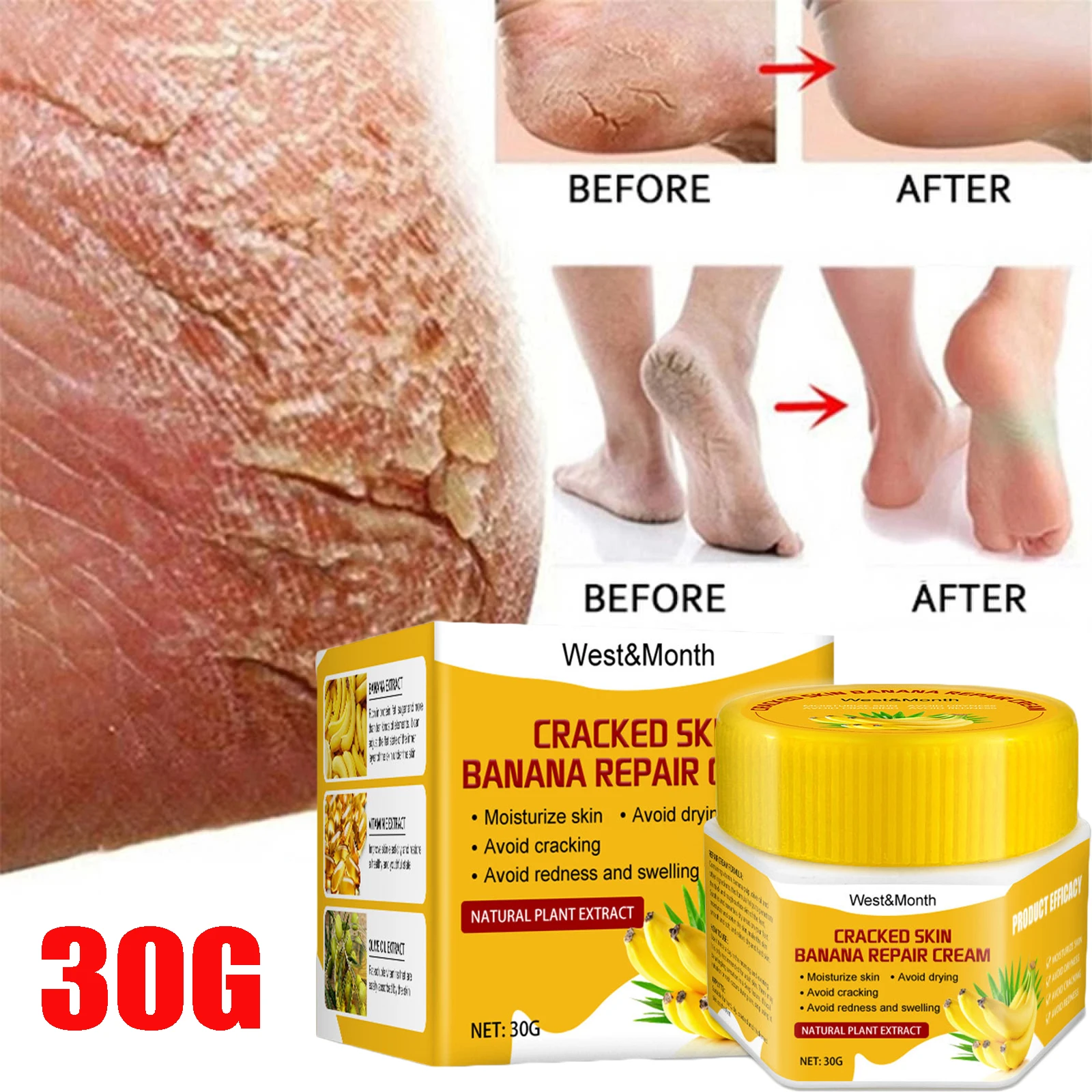 

New Hand and Foot Skin Repairing Moisturizer Cream Anti-Chapping for Rough Dry and Cracked Chapped Feet Heel Repair Foot Cream