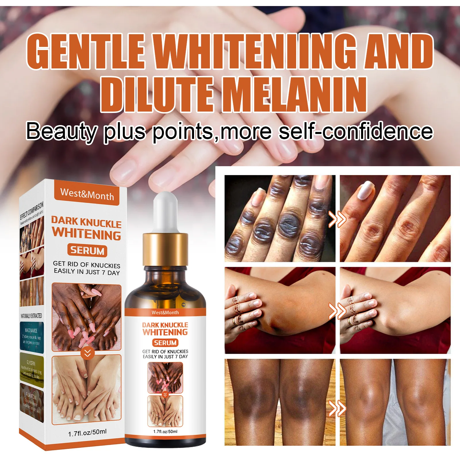Get Rid Of Dark Knuckles In 7 Days Serum Whitening Removing Dark Knuckles Serum Hand knuckle Eraser Serum for Elbow and Knee
Get Rid Of Dark Knuckles In 7 Days Serum Whitening Removing Dark Knuckles Serum Hand knuckle Eraser Serum for Elbow and Knee