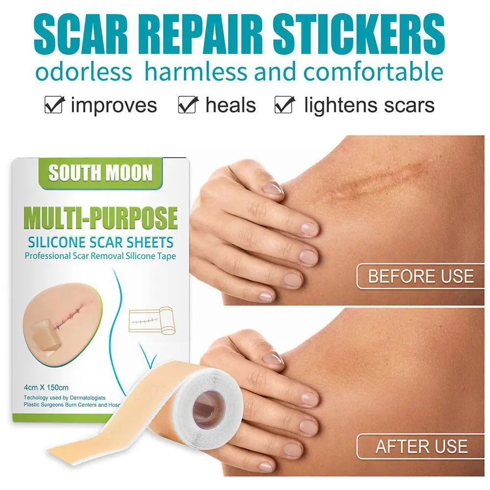 150cm Fade Scar Sticker Efficient Beauty Scars Removal Gel Acne Tape Spot Skin Burn Tone Repair Self-adhesive Patch Silicon E8R0
150cm Fade Scar Sticker Efficient Beauty Scars Removal Gel Acne Tape Spot Skin Burn Tone Repair Self-adhesive Patch Silicon E8R0