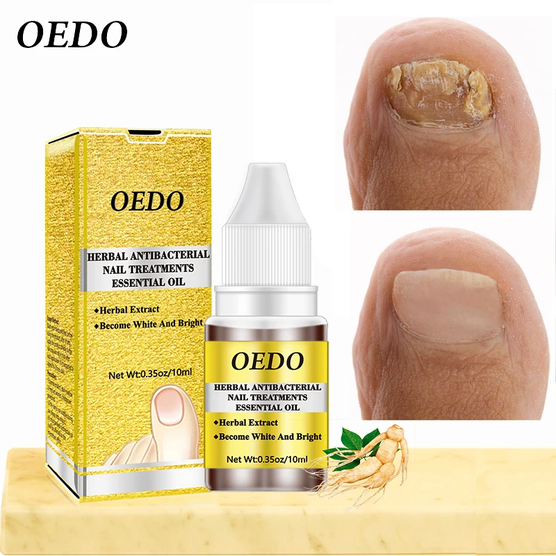 OEDO Fungal Nail Repair Treatment Anti Fungus Serum Essence Onychomycosi Paronychia Anti-Fungus Anti Infection Toe Nails Care
OEDO Fungal Nail Repair Treatment Anti Fungus Serum Essence Onychomycosi Paronychia Anti-Fungus Anti Infection Toe Nails Care