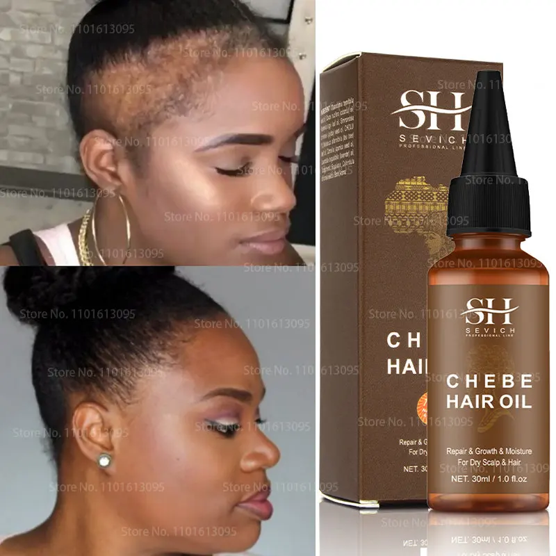 

Африканское масло для наращивания волос Chebe, масло для роста волос с очень быстрыми краями, масло для волос Alopecia, 30 мл