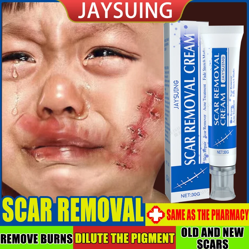 Scar removal cream hyperplastic scars scar gel scar repair burn cae sarean section surgical scars scar removal scar bumps
Scar removal cream hyperplastic scars scar gel scar repair burn cae sarean section surgical scars scar removal scar bumps