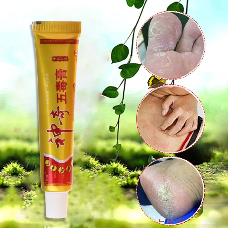 28ED Body Psoriasis Dermatitis Eczema Skin Problems Chinese Herbal Cream Ointment New
28ED Body Psoriasis Dermatitis Eczema Skin Problems Chinese Herbal Cream Ointment New