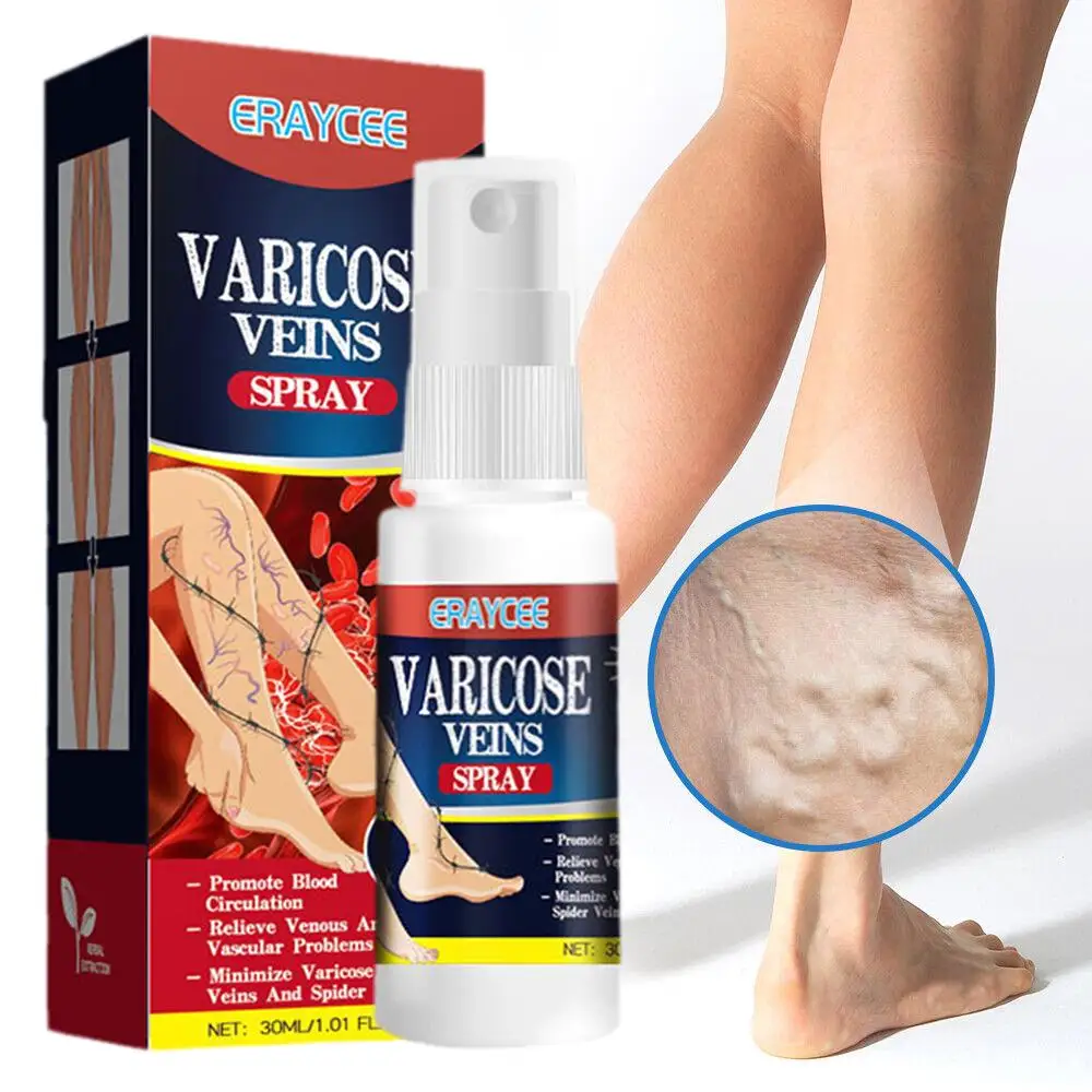 Effective Herbal Varicose Vein Relief Cream Relieve Pain Spider Phlebitis Vasculitis Leg 30ml Treatment Swelling G1K5
Effective Herbal Varicose Vein Relief Cream Relieve Pain Spider Phlebitis Vasculitis Leg 30ml Treatment Swelling G1K5
