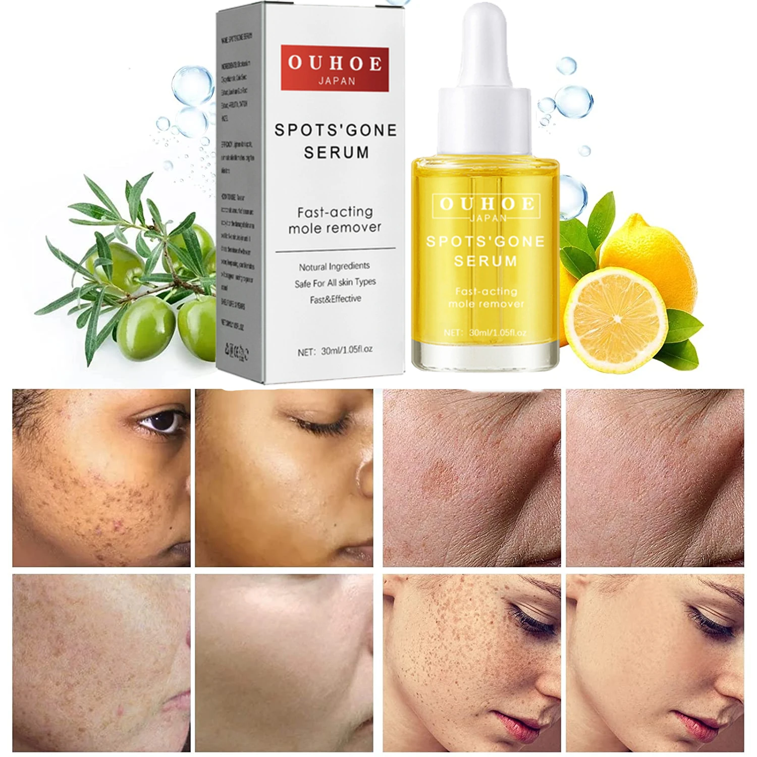 Whitening Spot Serum Remove Freckles Chloasma Dark Spots Hyperpigmentation Age Spots Sun Spots Light Spots And Brighten Skin
Whitening Spot Serum Remove Freckles Chloasma Dark Spots Hyperpigmentation Age Spots Sun Spots Light Spots And Brighten Skin