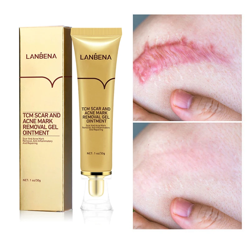 LANBENA Acne Scar Cream Weaken Pimple Marks Narrow Pores Curb Regeneration Of Pimples Scar And Acne Mark Removal Gel Oimtment
LANBENA Acne Scar Cream Weaken Pimple Marks Narrow Pores Curb Regeneration Of Pimples Scar And Acne Mark Removal Gel Oimtment