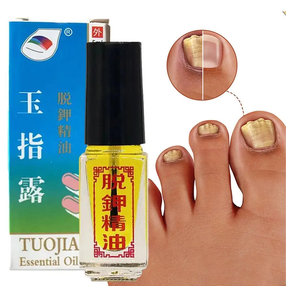 5ml Fungal Nail Treatment Oil Foot Repair Essence Toe Nail Fungus Removal Gel Anti Infection Cream Fungal Nail Removal
5ml Fungal Nail Treatment Oil Foot Repair Essence Toe Nail Fungus Removal Gel Anti Infection Cream Fungal Nail Removal