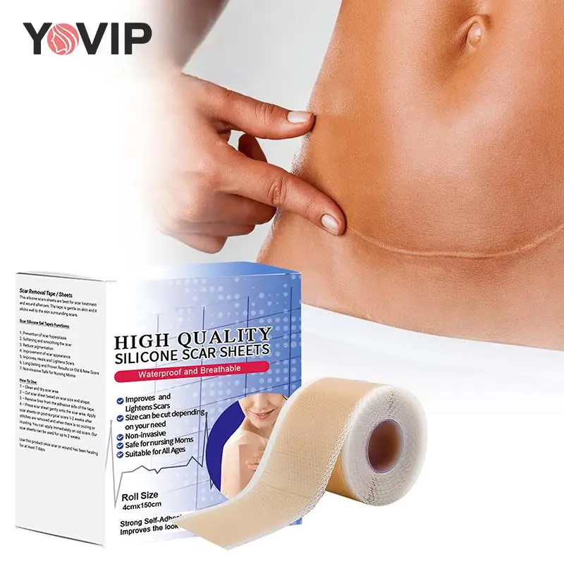 Silicone Scar Sheets Skin Repair Patch Removal Self-Adhesive Stretch Mark Tape Therapy Patch Burn Acne Scar Skin Care
Silicone Scar Sheets Skin Repair Patch Removal Self-Adhesive Stretch Mark Tape Therapy Patch Burn Acne Scar Skin Care