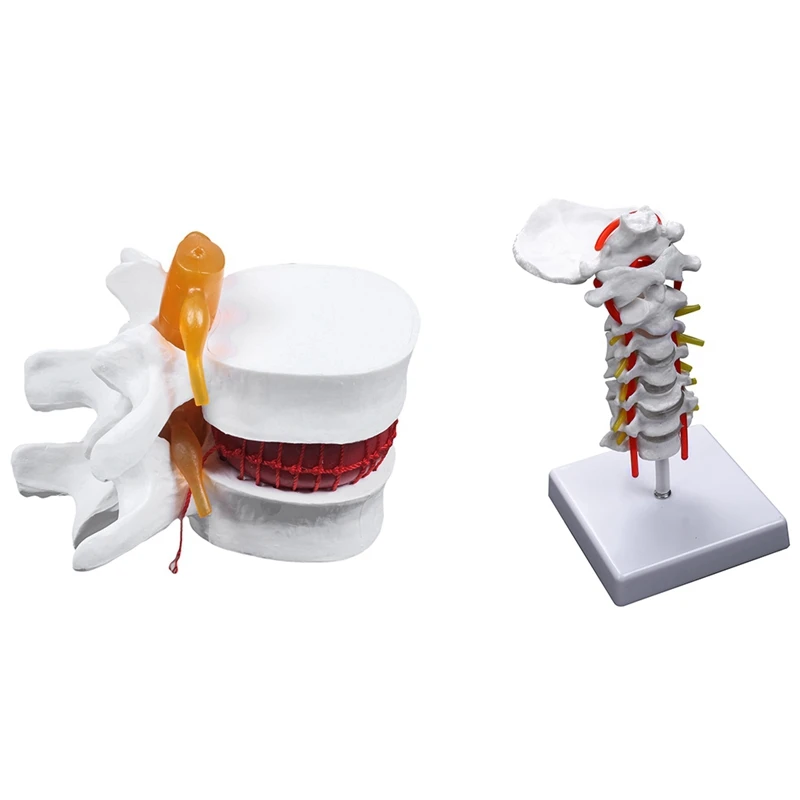 1 Pcs Human Anatomy Skeleton Spine Lumbar Disc Teaching Model & 1 Pcs Cervical Vertebra Arteria Spine Nerves Model
1 Pcs Human Anatomy Skeleton Spine Lumbar Disc Teaching Model & 1 Pcs Cervical Vertebra Arteria Spine Nerves Model