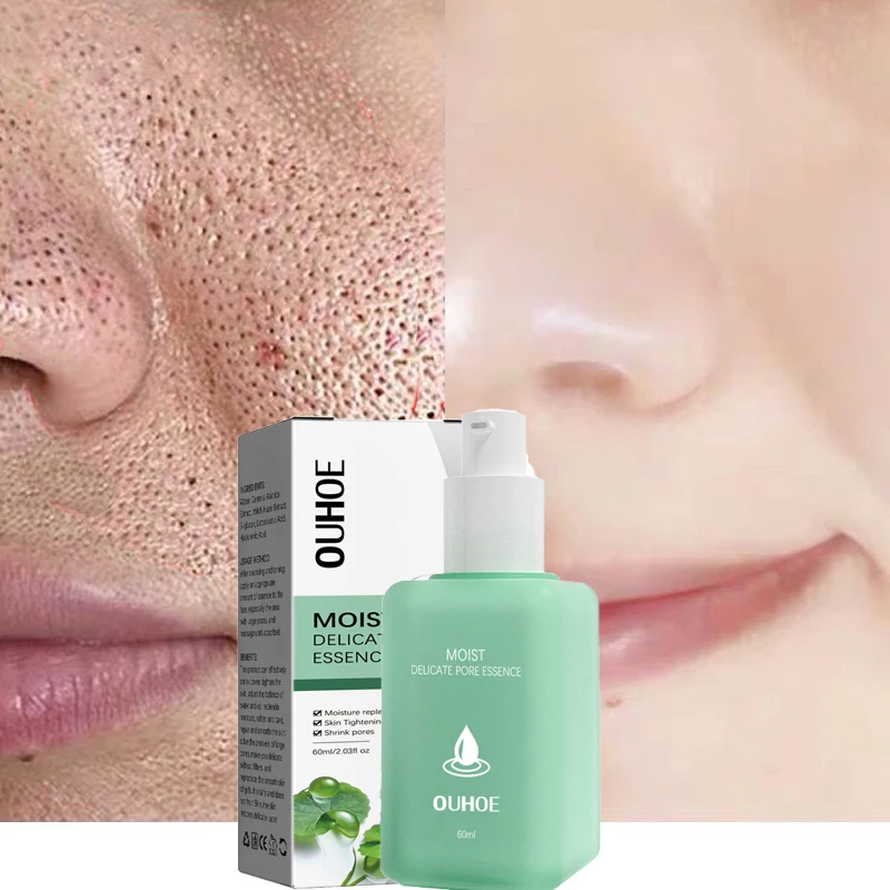 Лактобионовая кислота, сужение пор, сыворотка для лица, удаление столешницы, Восстанавливающее Средство, гладкая красота, уход за кожей
Лактобионовая кислота, сужение пор, сыворотка для лица, удаление столешницы, Восстанавливающее Средство, гладкая красота, уход за кожей